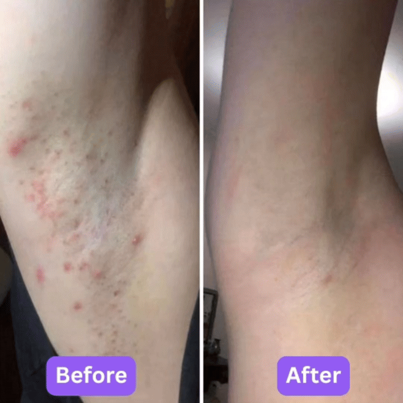 Lovana Body Hair Removal Cream