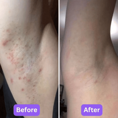 Lovana Body Hair Removal Cream